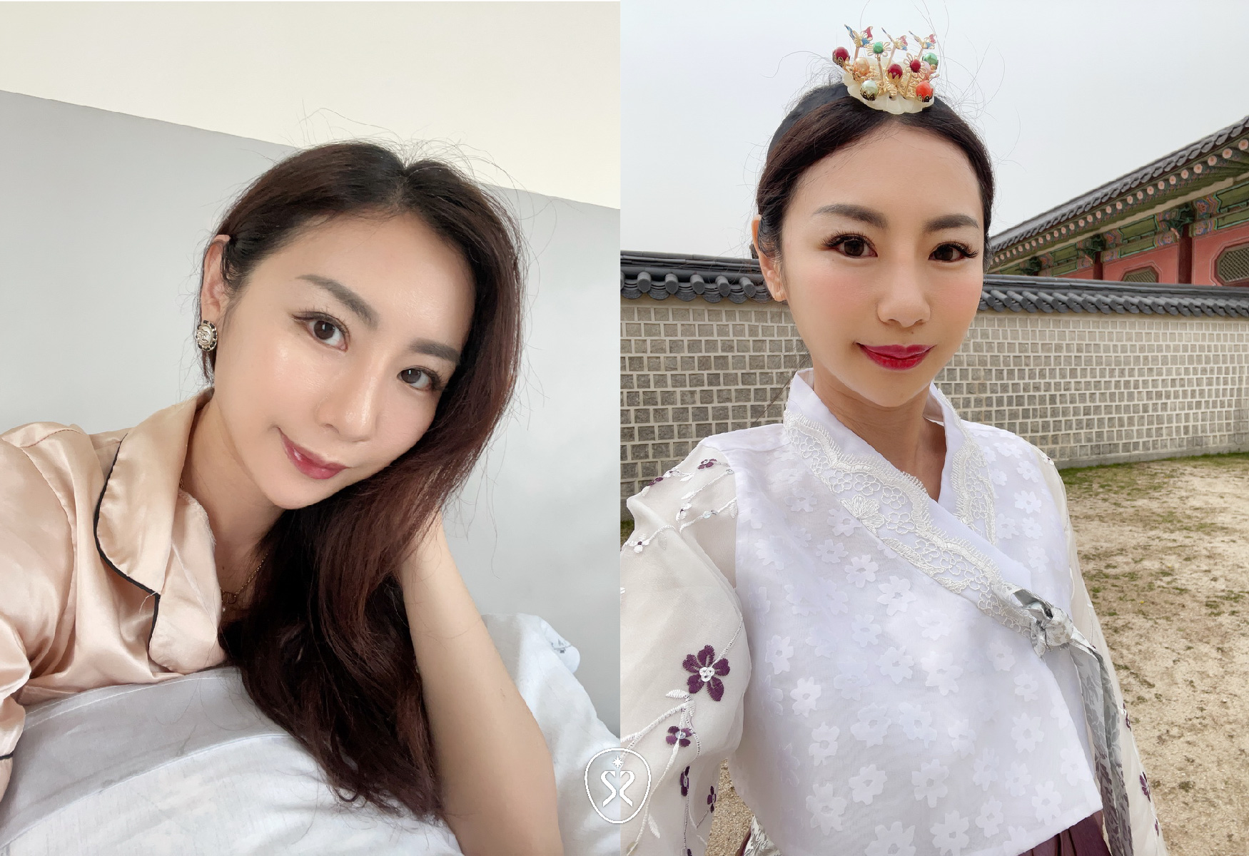 【玻尿酸】星采皮膚專科診所(古亭)-不再焦慮！輕鬆獲得一個順眼的自己 -小雯媽咪愛漂亮